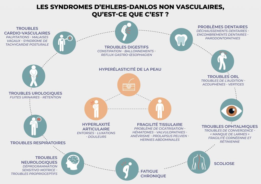 Types de SED - Qu'est-ce que le SED non vasculaire